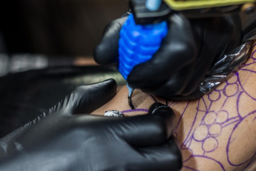 Laser tatuaggio - Foto di Gabriel Lara/ Pexels.com